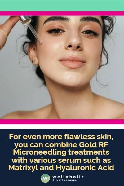 为了获得更加完美无瑕的肌肤，您可以结合金色RF微针疗程。