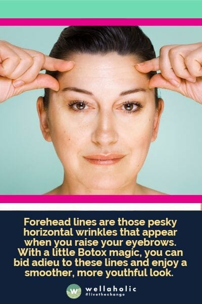 Forehead lines are those pesky horizontal wrinkles that appear when you raise your eyebrows. With a little Botox magic, you can bid adieu to these lines and enjoy a smoother, more youthful look.