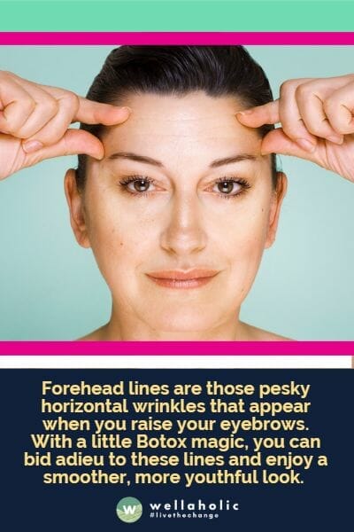 Forehead lines are those pesky horizontal wrinkles that appear when you raise your eyebrows. With a little Botox magic, you can bid adieu to these lines and enjoy a smoother, more youthful look. 