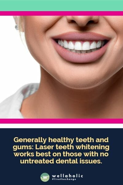 Generally healthy teeth and gums: Laser teeth whitening works best on those with no untreated dental issues.