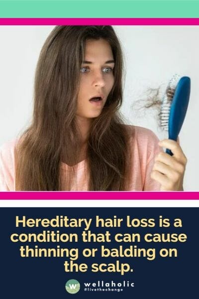Hereditary hair loss is a condition that can cause thinning or balding on the scalp.