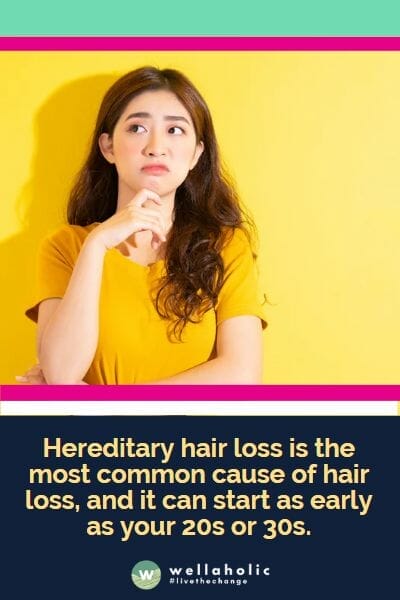 Hereditary hair loss is the most common cause of hair loss, and it can start as early as your 20s or 30s.
