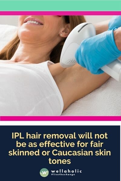 IPL hair removal will not be as effective for fair skinned or caucasian skin tones