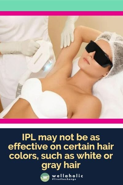 IPL may not be as effective on certain hair colors, such as white or gray hair