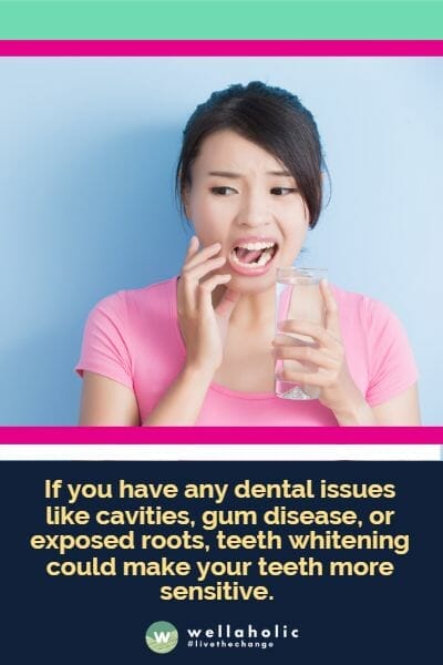 If you have any dental issues like cavities, gum disease, or exposed roots, teeth whitening could make your teeth more sensitive.