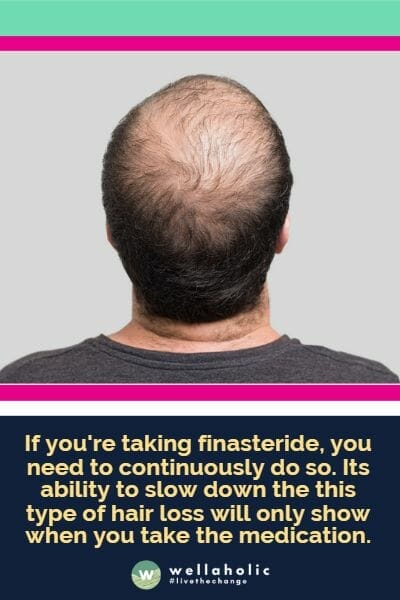 If you're taking finasteride, you need to continuously do so. Its ability to slow down the this type of hair loss will only show when you take the medication.