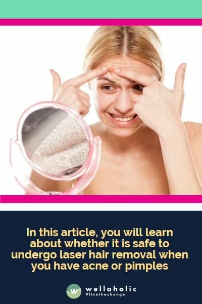 In this article, you will learn about whether it is safe to undergo laser hair removal when you have acne or pimples