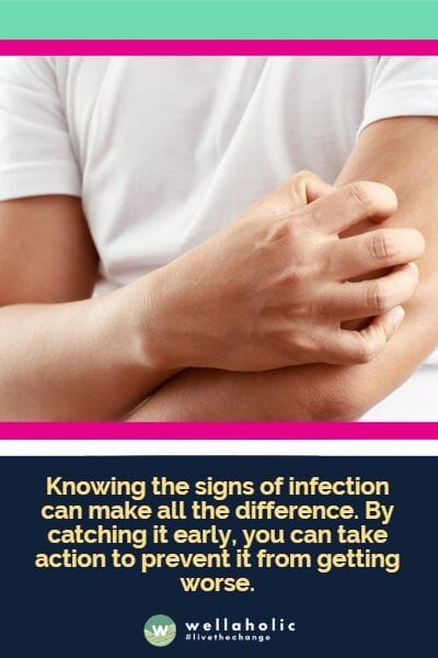 Knowing the signs of infection can make all the difference. By catching it early, you can take action to prevent it from getting worse.
