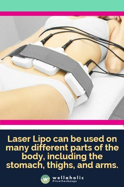 Laser Lipo can be used on many different parts of the body, including the stomach, thighs, and arms.