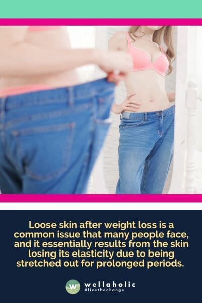 Loose skin after weight loss is a common issue that many people face, and it essentially results from the skin losing its elasticity due to being stretched out for prolonged periods. 
