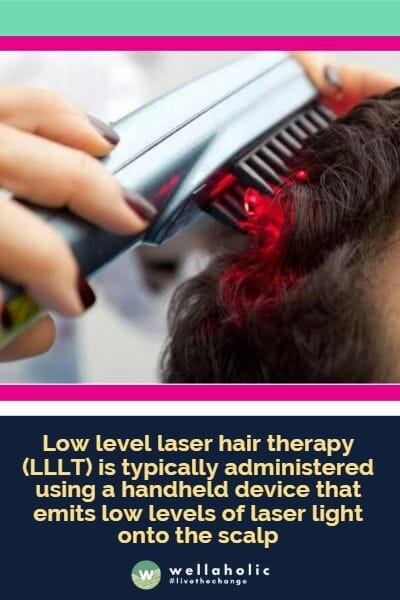 Low level laser hair therapy (LLLT) is typically administered using a handheld device that emits low levels of laser light onto the scalp