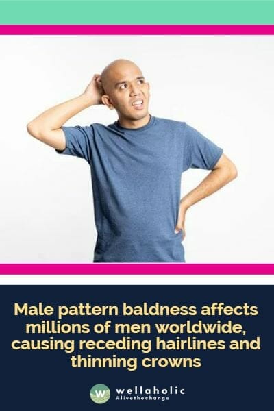 Male pattern baldness affects millions of men worldwide, causing receding hairlines and thinning crowns