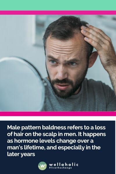 Male pattern baldness refers to a loss of hair on the scalp in men. It happens as hormone levels change over a man's lifetime, and especially in the later years