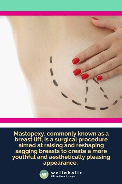 Mastopexy, commonly known as a breast lift, is a surgical procedure aimed at raising and reshaping sagging breasts to create a more youthful and aesthetically pleasing appearance.