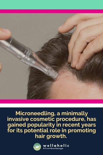 Microneedling, a minimally invasive cosmetic procedure, has gained popularity in recent years for its potential role in promoting hair growth. 