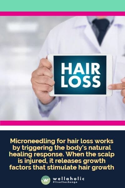 Microneedling for hair loss works by triggering the body's natural healing response. When the scalp is injured, it releases growth factors that stimulate hair growth