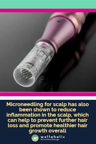 Microneedling for scalp has also been shown to reduce inflammation in the scalp, which can help to prevent further hair loss and promote healthier hair growth overall