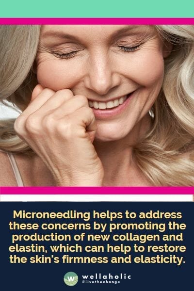 Microneedling helps to address these concerns by promoting the production of new collagen and elastin, which can help to restore the skin's firmness and elasticity.