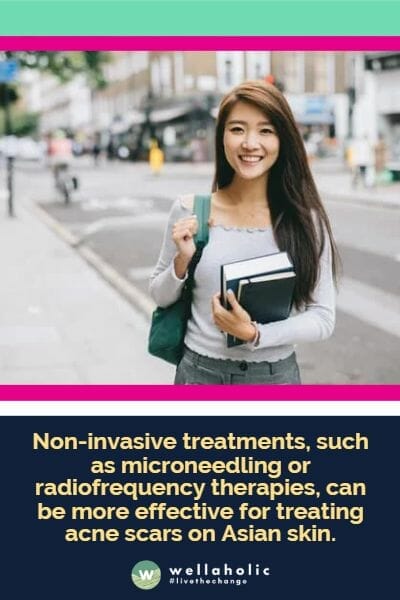 Non-invasive treatments, such as microneedling or radiofrequency therapies, can be more effective for treating acne scars on Asian skin.