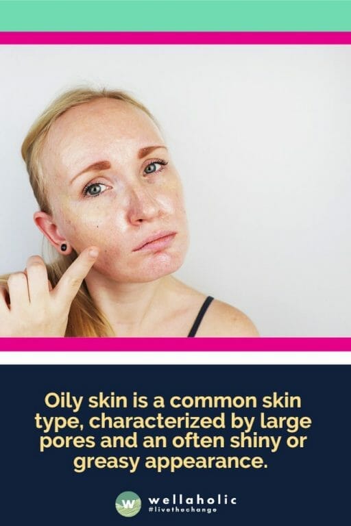 Oily skin is a common skin type, characterized by large pores and an often shiny or greasy appearance. 