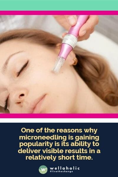 One of the reasons why microneedling is gaining popularity is its ability to deliver visible results in a relatively short time. Unlike some treatments that require multiple sessions before seeing noticeable changes, microneedling can show improvements quickly. 