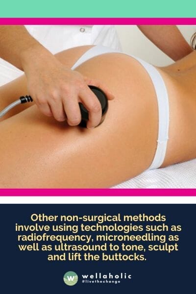 Other non-surgical methods involve using technologies such as radiofrequency, microneedling as well as ultrasound to tone, sculpt and lift the buttocks. 