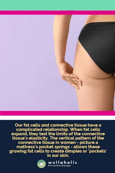 我们的脂肪细胞和结缔组织之间存在着复杂的关系。当脂肪细胞扩大时，它们会测试结缔组织弹性的极限。女性身上的纵向结缔组织模式——就像床垫上的独立弹簧一样——使得这些不断增长的脂肪细胞在我们的皮肤中形成凹陷或者所谓的“隔间”。