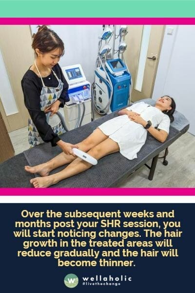 Over the subsequent weeks and months post your SHR session, you will start noticing changes. The hair growth in the treated areas will reduce gradually and the hair will become thinner.