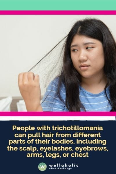 People with trichotillomania can pull hair from different parts of their bodies, including the scalp, eyelashes, eyebrows, arms, legs, or chest