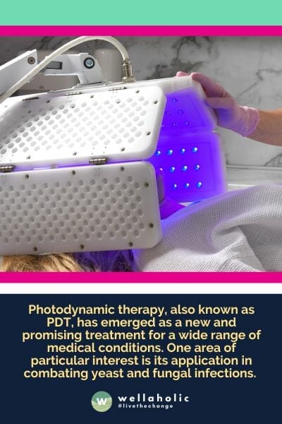 光动力疗法，又称PDT，已成为治疗多种医学疾病的新兴和有前途的方法。其中一个特别引人关注的领域是它在对抗酵母和真菌感染方面的应用。