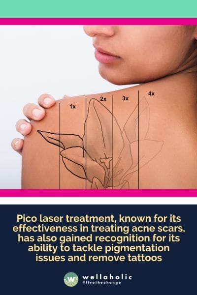 Pico laser treatment, known for its effectiveness in treating acne scars, has also gained recognition for its ability to tackle pigmentation issues and remove tattoos
