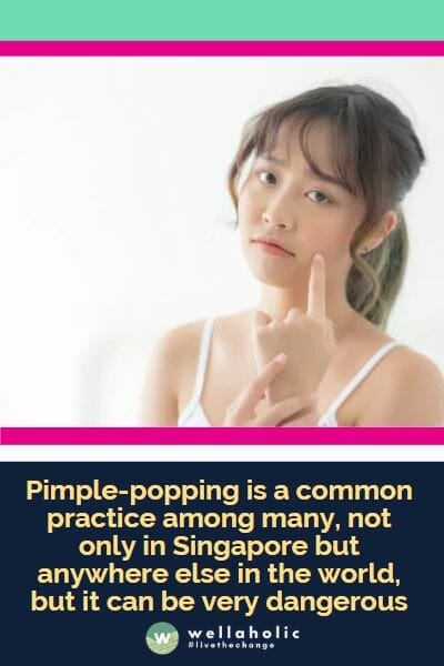 Pimple-popping is a common practice among many, not only in Singapore but anywhere else in the world, but it can be very dangerous