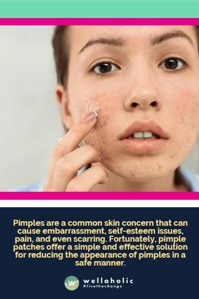 Pimples are a common skin concern that can cause embarrassment, self-esteem issues, pain, and even scarring. Fortunately, pimple patches offer a simple and effective solution for reducing the appearance of pimples in a safe manner.