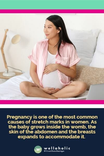 Pregnancy is one of the most common causes of stretch marks in women. As the baby grows inside the womb, the skin of the abdomen and the breasts expands to accommodate it. 