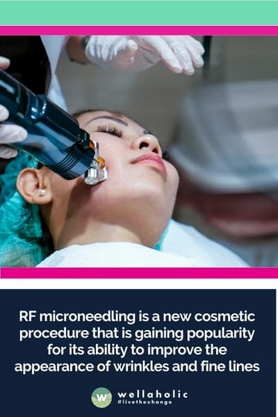 RF射频微针美容是一种新型的美容疗程，因其改善皱纹和细纹的能力而越来越受欢迎。