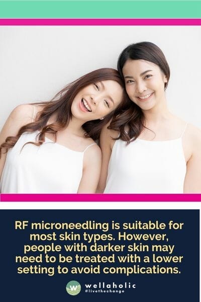 RF射频微针美容适用于大多数肤质。然而，皮肤较深的人可能需要使用较低的设置来避免并发症。