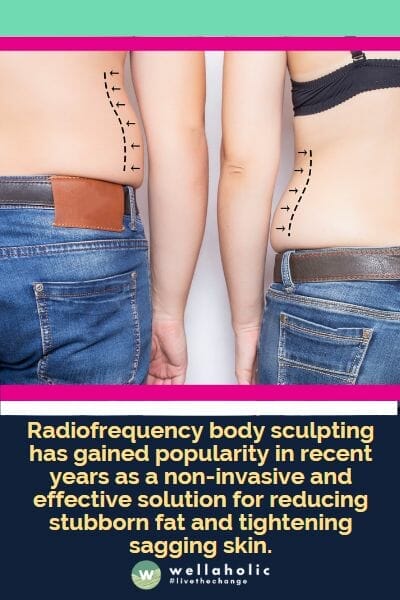 Radiofrequency body sculpting has gained popularity in recent years as a non-invasive and effective solution for reducing stubborn fat and tightening sagging skin.