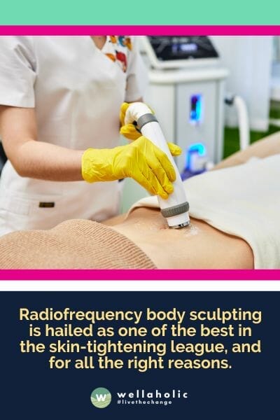 Radiofrequency body sculpting says, "Hold my energy!" Targeting problem areas like the arms and treating them like royalty, this treatment is all about perfection without the surgical fuss or extensive downtime. It's hailed as one of the best in the skin-tightening league, and for all the right reasons.