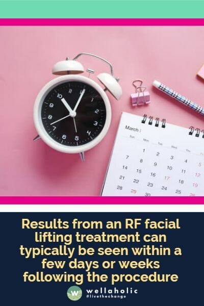 Results from an RF facial lifting treatment can typically be seen within a few days or weeks following the procedure