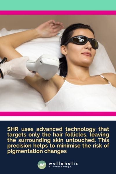 SHR uses advanced technology that targets only the hair follicles, leaving the surrounding skin untouched. This precision helps to minimise the risk of pigmentation changes