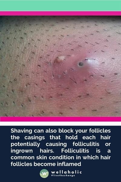 Shaving can also block your follicles the casings that hold each hair potentially causing folliculitis or ingrown hairs. Folliculitis is a common skin condition in which hair follicles become inflamed