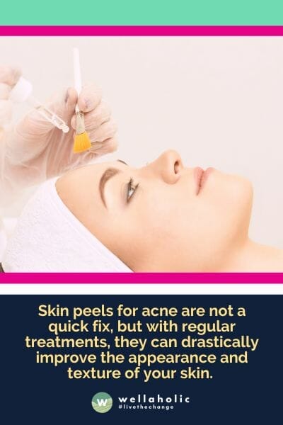 Skin peels for acne are not a quick fix, but with regular treatments, they can drastically improve the appearance and texture of your skin. 
