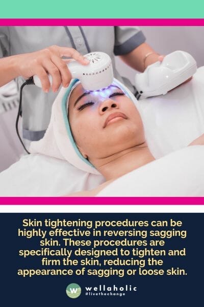 Skin tightening procedures can be highly effective in reversing sagging skin. These procedures are specifically designed to tighten and firm the skin, reducing the appearance of sagging or loose skin.