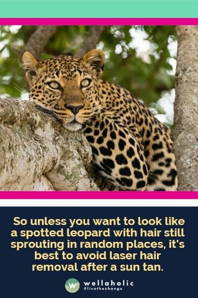 所以，除非你想看起来像斑点豹，毛发仍然随机生长在各个地方，最好在晒太阳后避免激光脱毛。