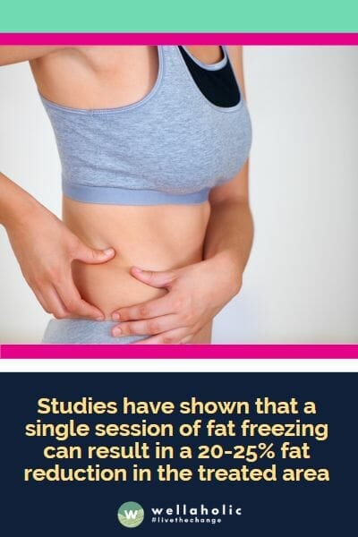 Studies have shown that a single session of fat freezing can result in a 20-25% fat reduction in the treated area