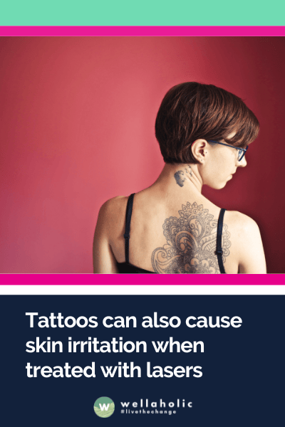 Tattoos can also cause skin irritation when treated with lasers