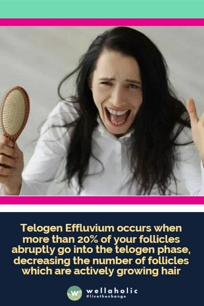 A person, wearing a white top, is holding up a handful of hair and a wooden brush, indicating hair loss. Below is an informational text about Telogen Effluvium, explaining that it occurs when more than 20% of hair follicles enter the telogen phase, leading to a decrease in actively growing hair.