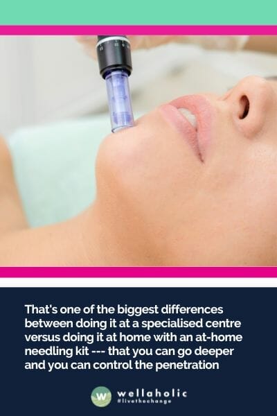 That's one of the biggest differences between doing it at a specialised centre versus doing it at home with an at-home needling kit --- that you can go deeper and you can control the penetration