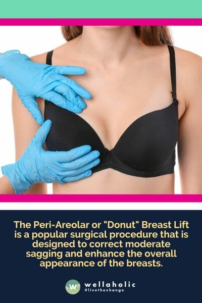 The Peri-Areolar or "Donut" Breast Lift is a popular surgical procedure that is designed to correct moderate sagging and enhance the overall appearance of the breasts.