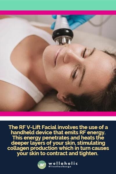 The RF V-Lift Facial involves the use of a handheld device that emits RF energy. This energy penetrates and heats the deeper layers of your skin, stimulating collagen production which in turn causes your skin to contract and tighten.